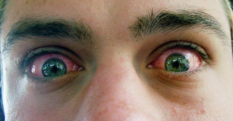 красные глаза марихуана
