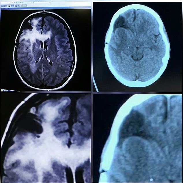 scan-mri.jpg