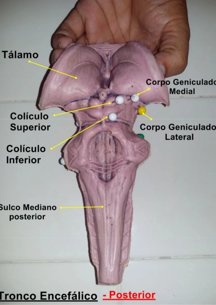 troncoenceflicoposterior-141011214231-conversion-gate01-thumbnail-4.thumb.webp.97a3babdac973874e00d3e1858279d33.webp