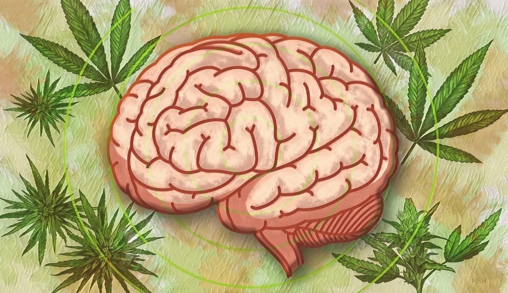 cannabis-brain.jpg