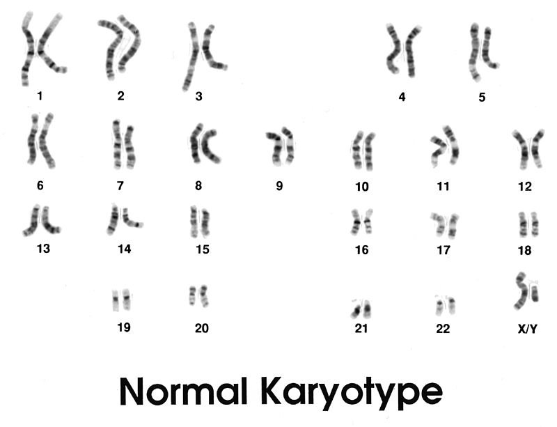 Karyotype_(normal).jpg.e1fa21e7d70f1b2c3d2fc1b1c500646a.jpg