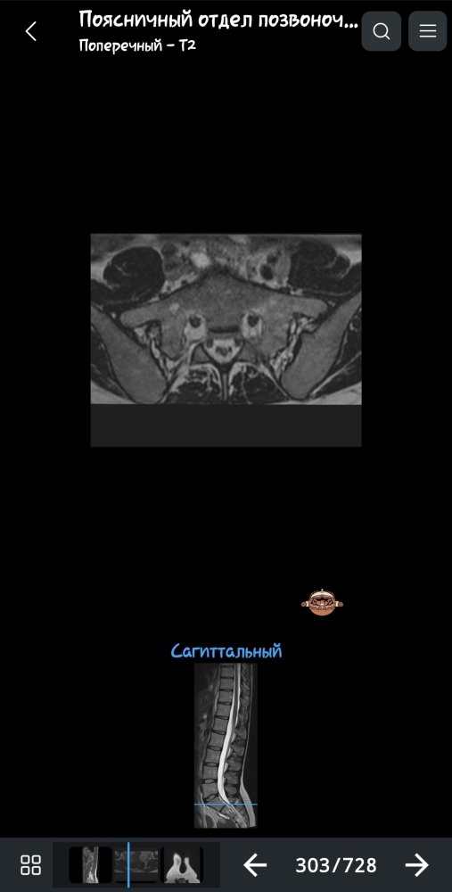 Screenshot_20230807-104101_e-Anatomy.thumb.jpg.8026f55fec615fff016b6e002662af93.jpg