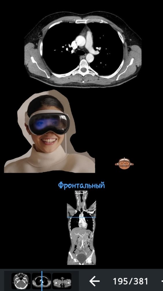 Screenshot_20230807-111730_e-Anatomy.thumb.jpg.31896eda958189e0b03bcd6d14d76ca1.jpg