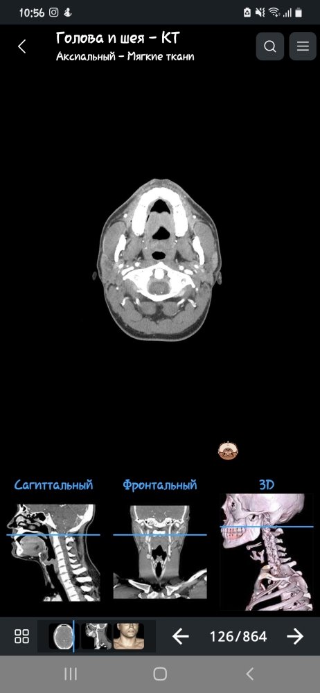 Screenshot_20230815-105605_e-Anatomy.thumb.jpg.b9e251958a4105333437e3af97418b5d.jpg