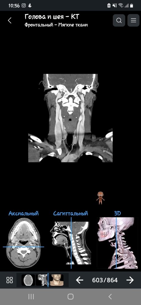 Screenshot_20230815-105656_e-Anatomy.thumb.jpg.e87d7699df3a996635e2df6bdc160d8d.jpg