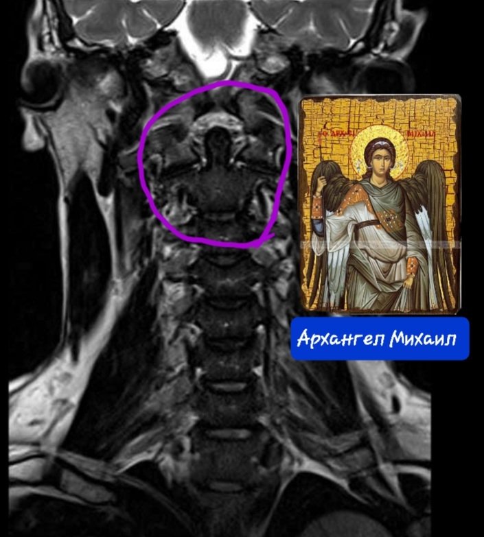 Screenshot_20230824-111534_e-Anatomy.jpg.84c7c79ca073d2ad754e547e513256e5.jpg