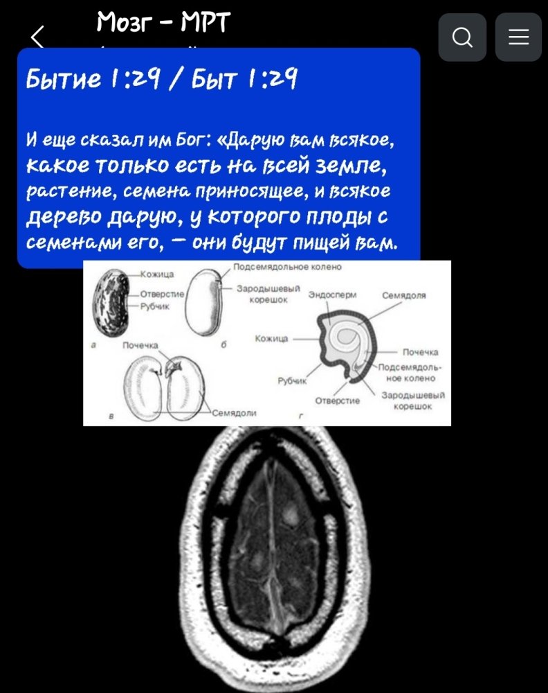 Screenshot_20230825-122148_e-Anatomy.thumb.jpg.8c75201fc6d73c616ee5b1875a9fe011.jpg