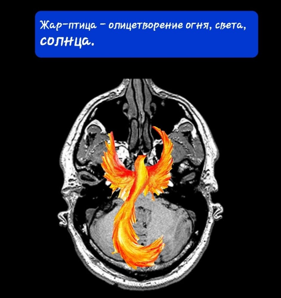 Screenshot_20230825-133129_e-Anatomy.thumb.jpg.c54cab1f0d561c96ba6e372099eb7b80.jpg