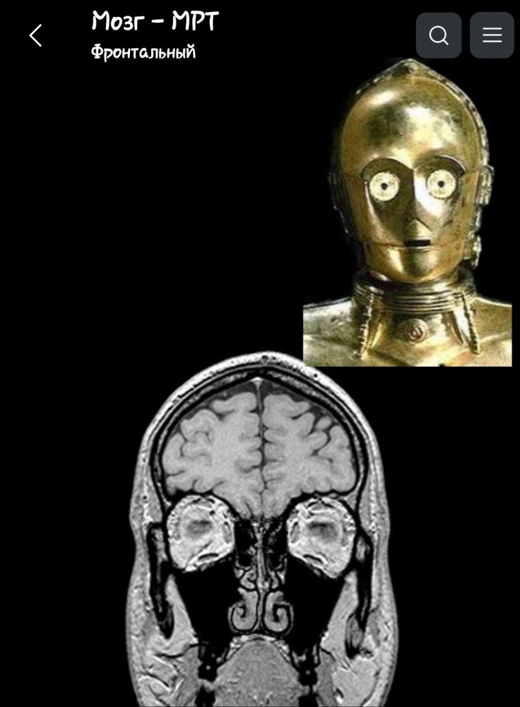 Screenshot_20230825-135152_e-Anatomy.thumb.jpg.fc99668a3919eed3ee8028499b92e389.jpg