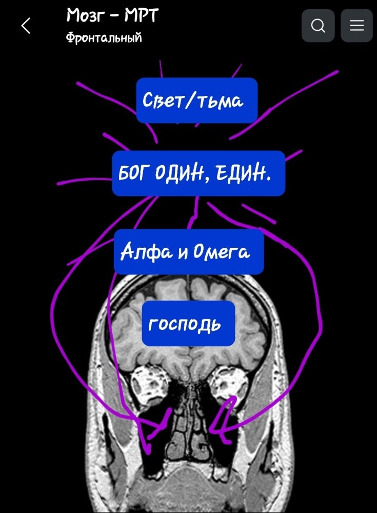 Screenshot_20230826-125354_e-Anatomy.thumb.jpg.bf63df0533fa2b7797e278ed22a800db.jpg