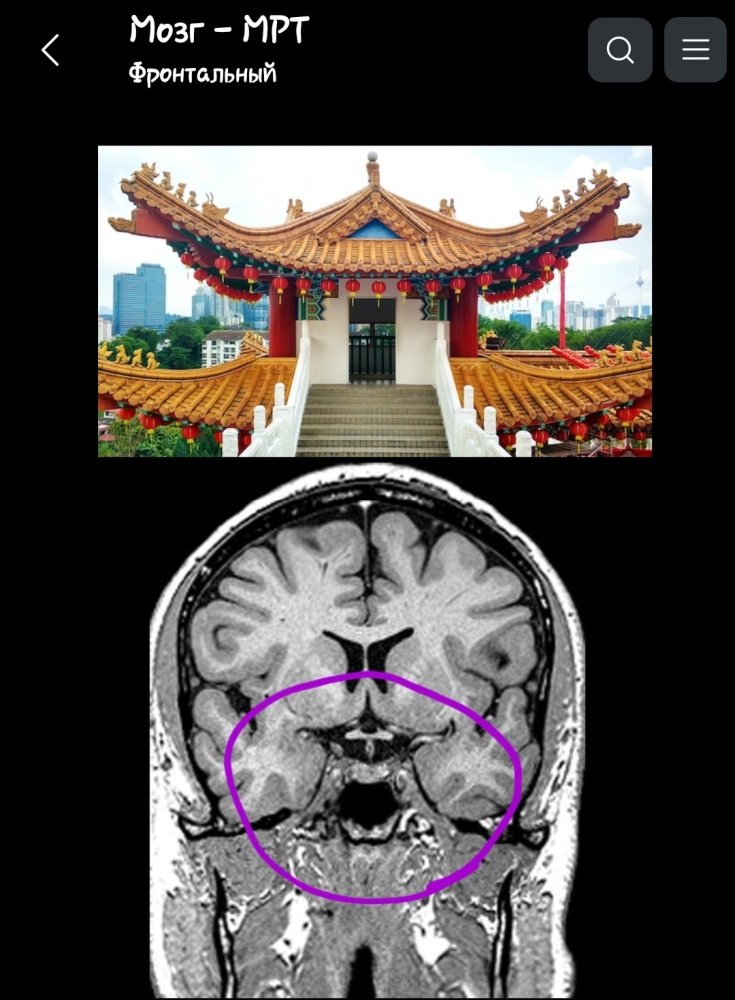 Screenshot_20230826-181805_e-Anatomy.jpg