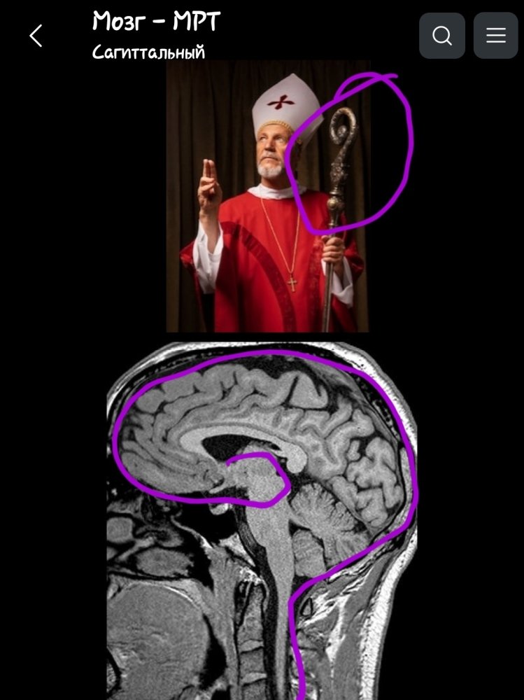 Screenshot_20230826-185510_e-Anatomy.thumb.jpg.8938f424111cf004b51bae5e1b93d9d7.jpg