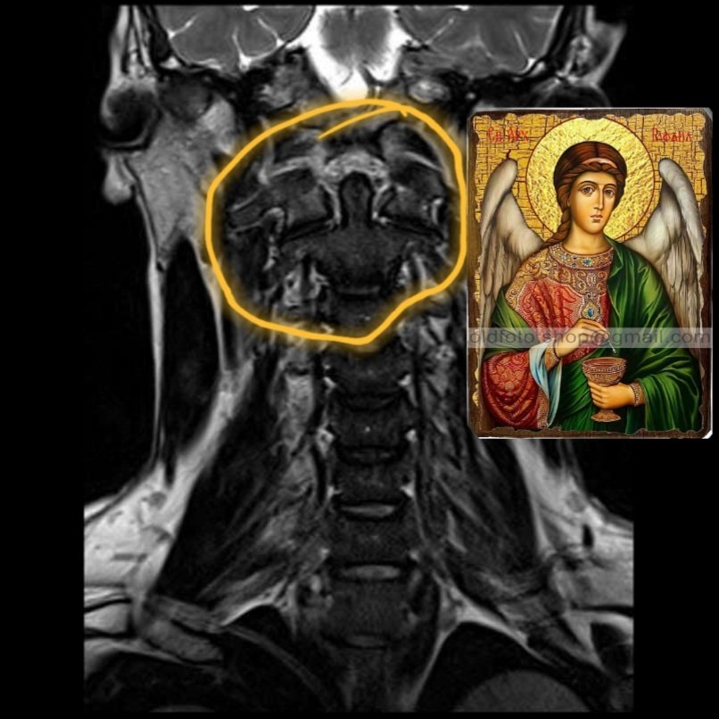 Screenshot_20230824-111525_e-Anatomy.jpg.9976ccdebc67462683046606cfea7cb2.jpg