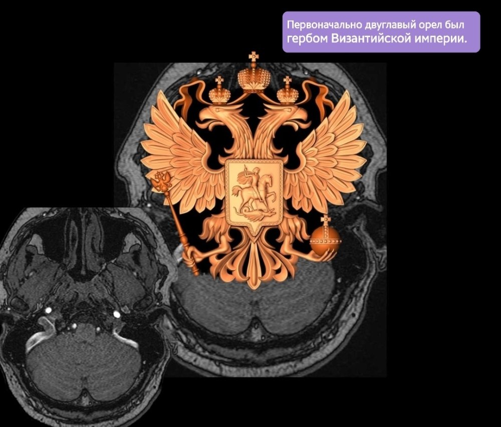 Screenshot_20230925-115237_e-Anatomy.thumb.jpg.173e6fa522149bb2f74ee7adccaca510.jpg