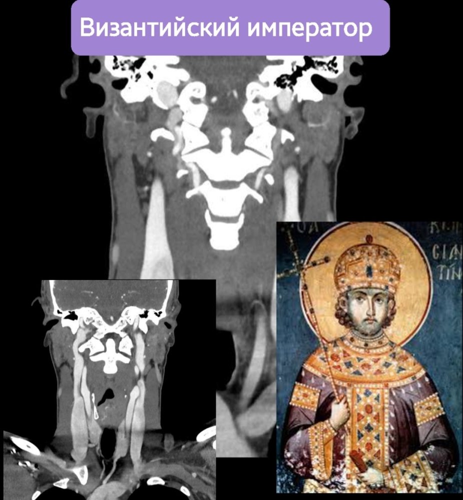 Screenshot_20230925-140326_e-Anatomy.thumb.jpg.9eacdacd7f4b677c3ec950efc764c30e.jpg