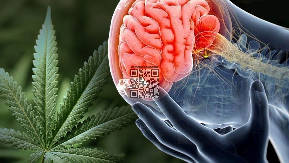 cannabis-brain.jpg
