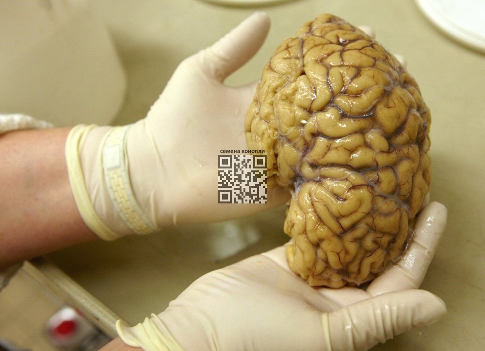 people-brain.jpg