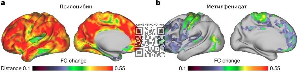 brain-function-psilocybin.jpg