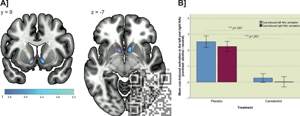 cbd-effect-on-brain-activation.jpg