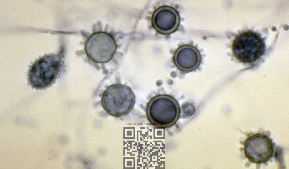 histoplasma-capsulatum-spores.jpg