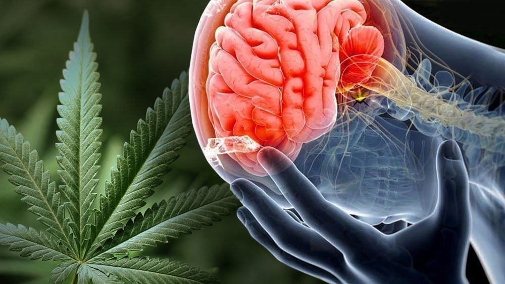 smoking-marijuana-with-a-concussion.jpeg.2d0f90f62bb141787228f4b890b496a7.jpeg