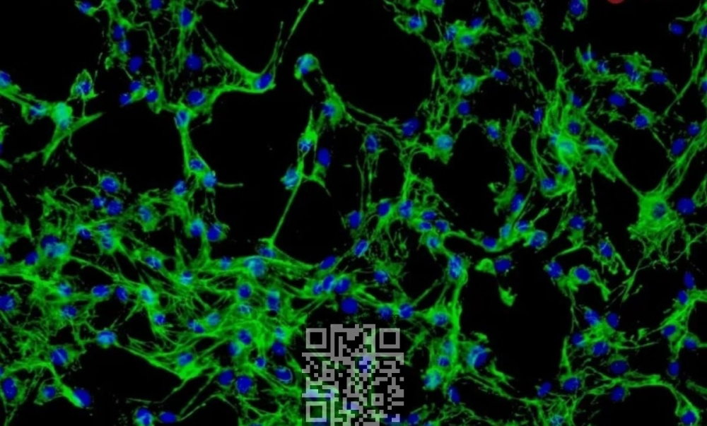 human-fibroblasts.jpg